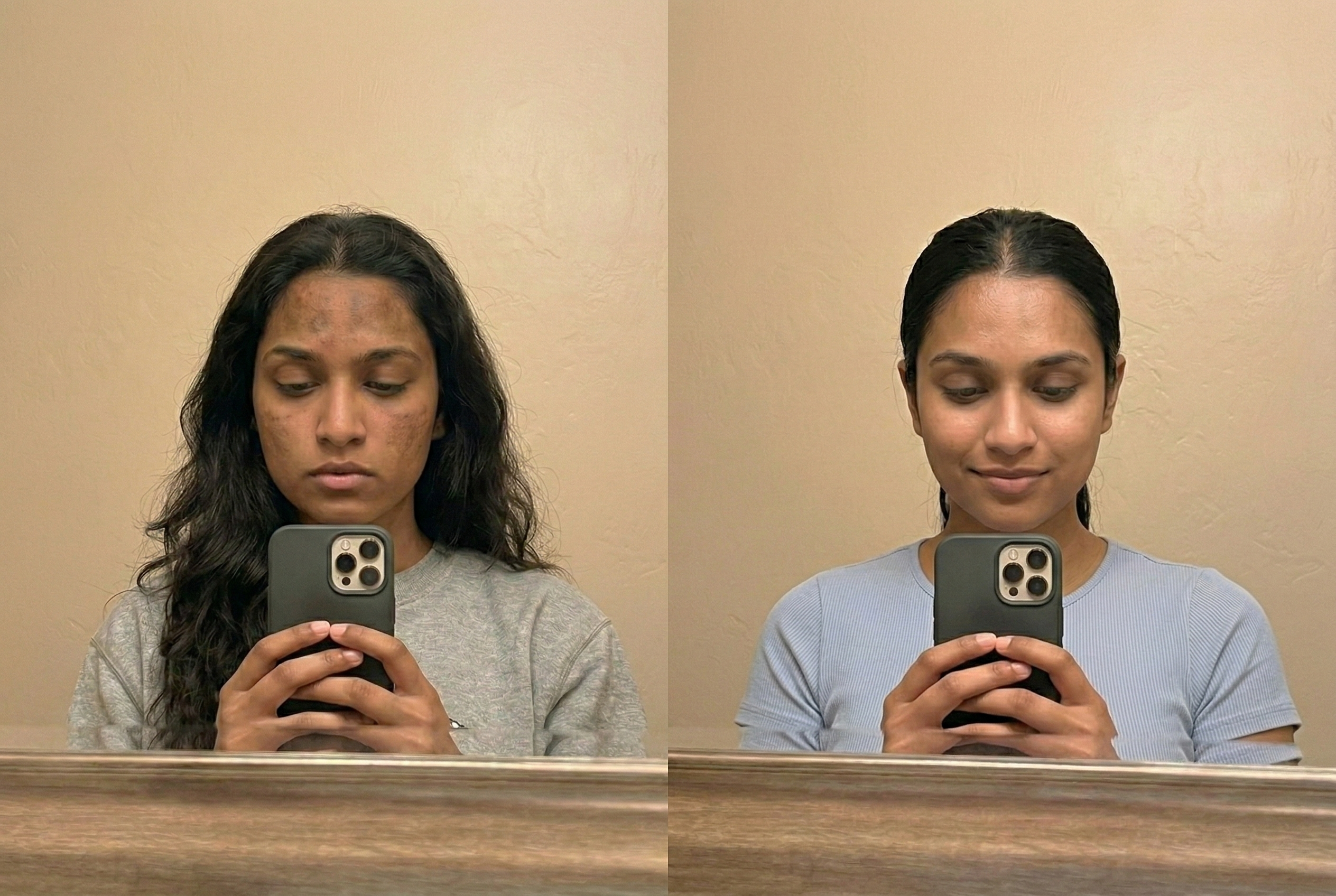 Aisha, 22 before and after using DARK